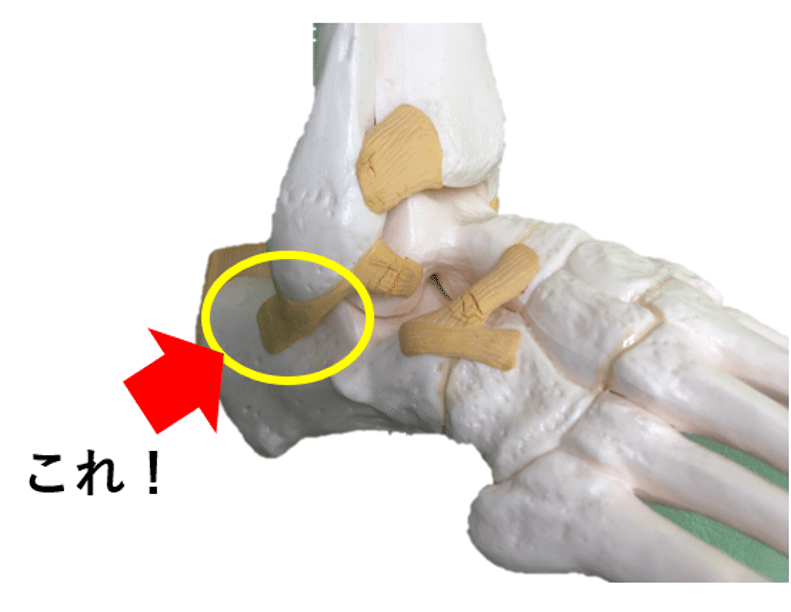 腓 靭帯 踵 足関節外側靭帯損傷(足関節捻挫)：足・膝｜札幌羊ヶ丘病院整形外科