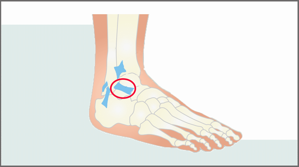 選手 指導者向け 足関節捻挫の応急処置からリハビリまで L Fit Note 選手 指導者向け 足関節捻挫の応急処置からリハビリまで L Fit Note