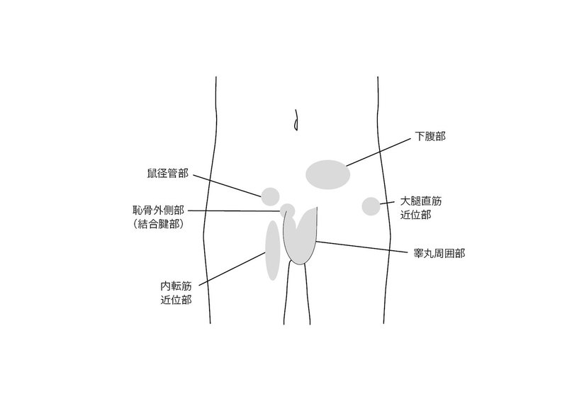 グロインペイン症候群の治療に関して たぼblog Note グロインペイン症候群の治療に関して たぼblog Note