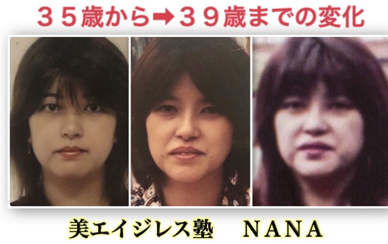 プチ整形に頼らないアンチエイジングを研究する美容家 顔のたるみはご自分で改善できます プチ整形 に頼らずエイジレスを目指す美容家 nana55歳 Note プチ整形に頼らないアンチエイジングを研究する美容家 顔のたるみはご自分で改善できます プチ整形 に頼らずエイジレスを目指す美容家 nana55歳 Note