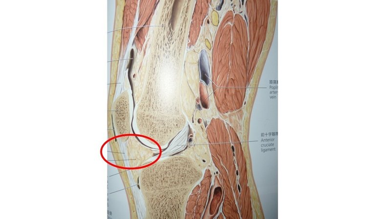 膝痛や可動域制限の原因 膝蓋下脂肪体の評価 アプローチまで解説 おっしー 理学療法士note Note 膝痛や可動域制限の原因 膝蓋下脂肪体の評価 アプローチまで解説 おっしー 理学療法士note Note