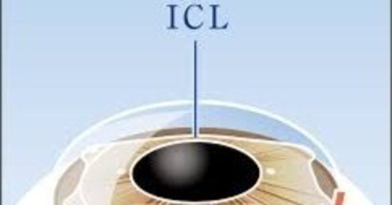 眼科コラム2】角膜のスペシャリスト「前眼部OCT」をご存じですか