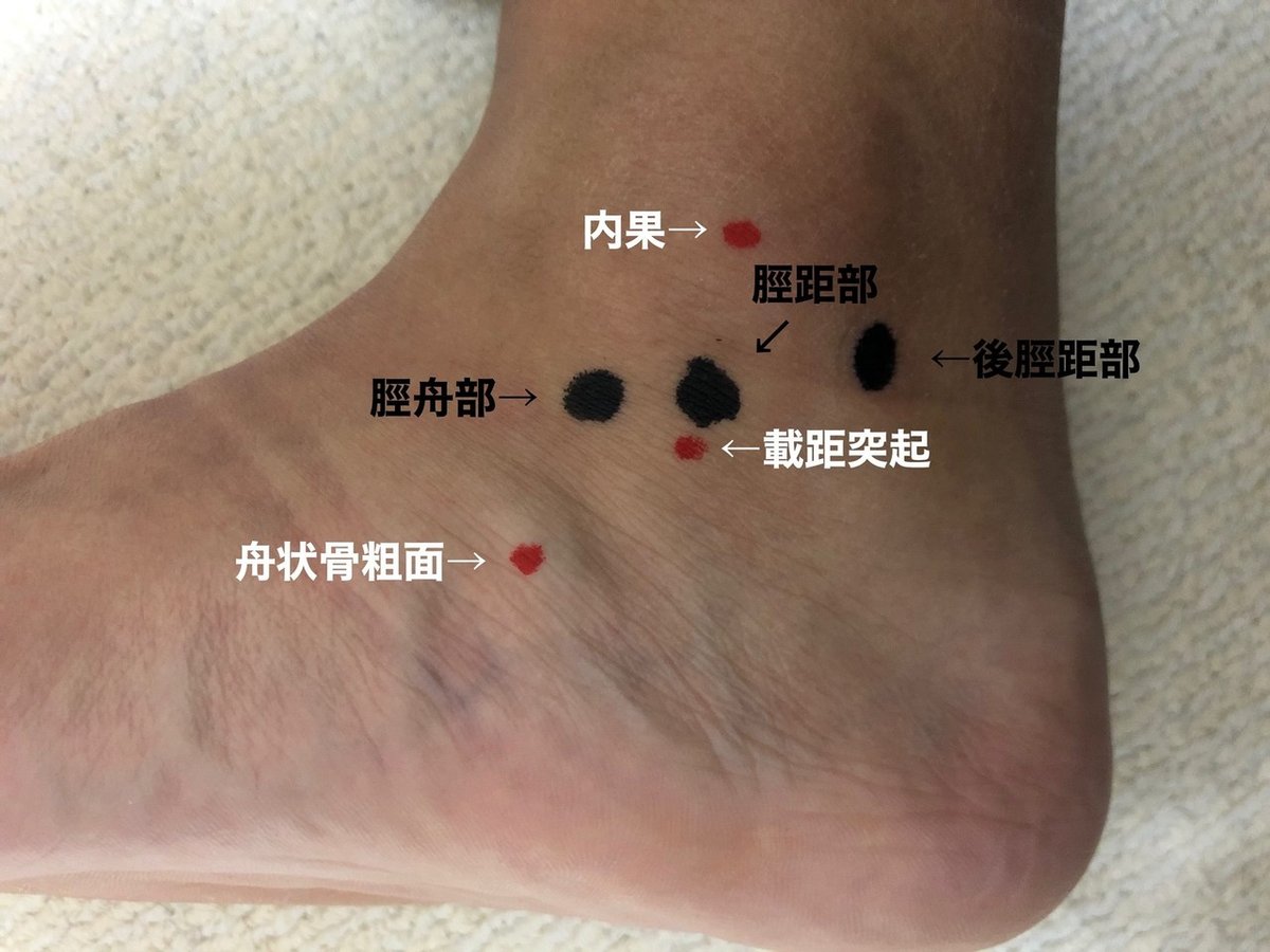 ◎裁断済み 足部・足関節の外傷 足部・足関節の外傷 診断・保存的治療・手術 | オンラインストア