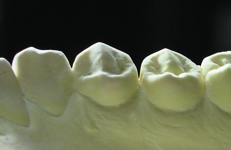 下顎右側小臼歯形態No2WEB3
