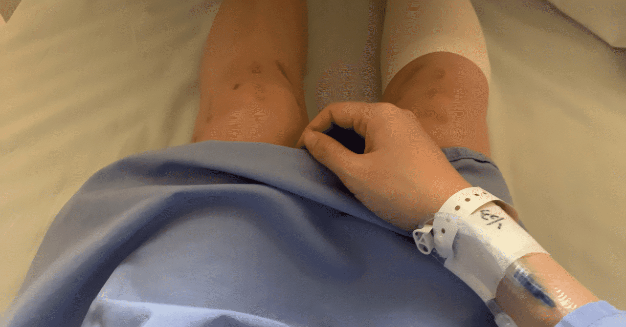 前十字靭帯断裂 の定番タグ記事一覧 Note つくる つながる とどける