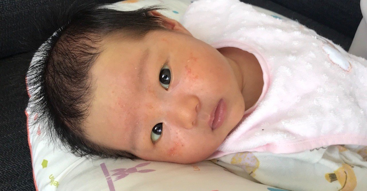 219日前 生後4週間が経ちました 芦田創 はじむ パラアスリート Note 219日前 生後4週間が経ちました 芦田創 はじむ パラアスリート Note