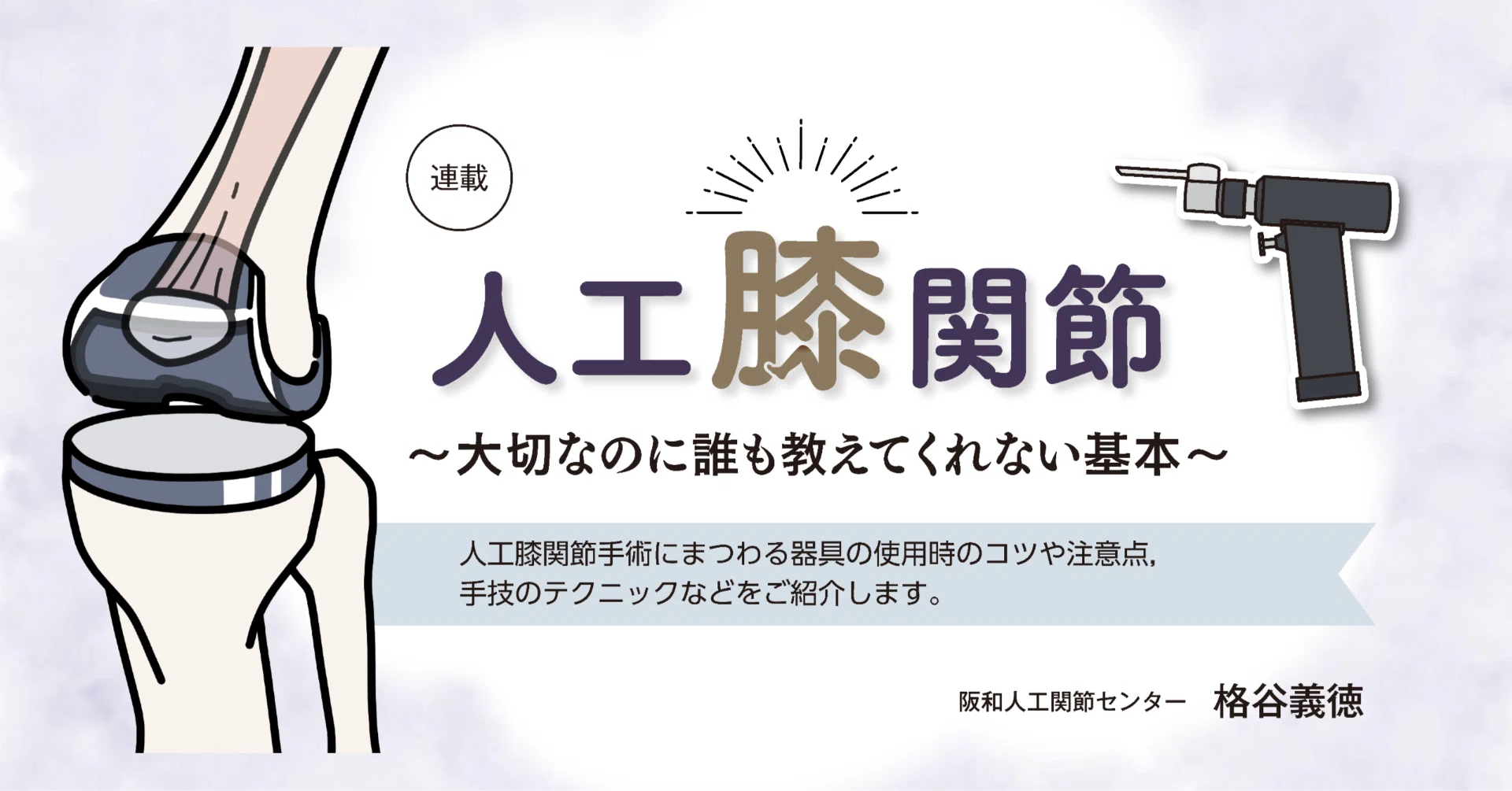 第7回 TKA surgeon が知っておくべきセメントの知識：備えよ常に