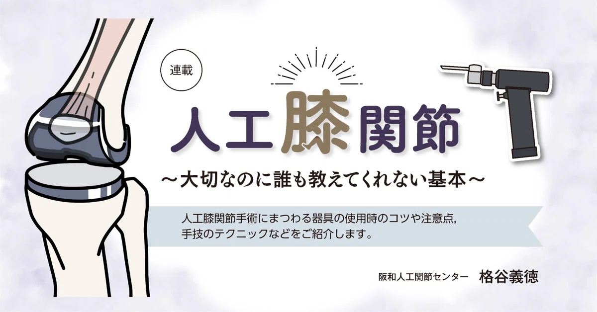 第7回 TKA surgeon が知っておくべきセメントの知識:備えよ常に 第7回 TKA surgeon が知っておくべきセメントの知識:備えよ常に