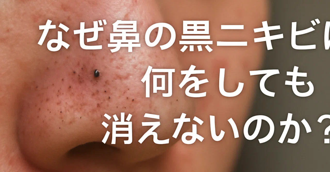 なぜ鼻の黒ニキビは何をしても消えないのか?|自己流ケアで悪化する理由と正しい毛穴対策とは|中濵数理, Ph.D.