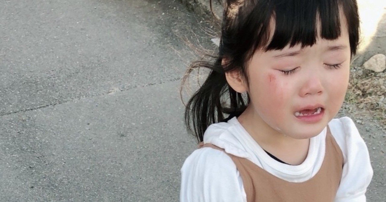 目覚めたら覚えのない傷が顔にありました すみぃ Note