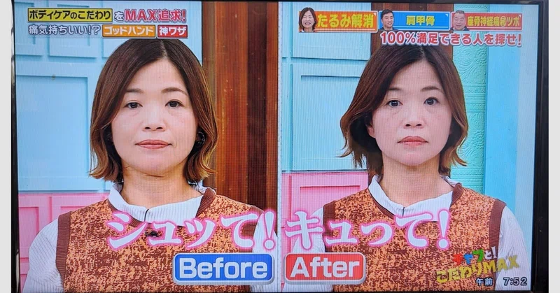 たるみ改善しすぎてテレビ出演：自己紹介