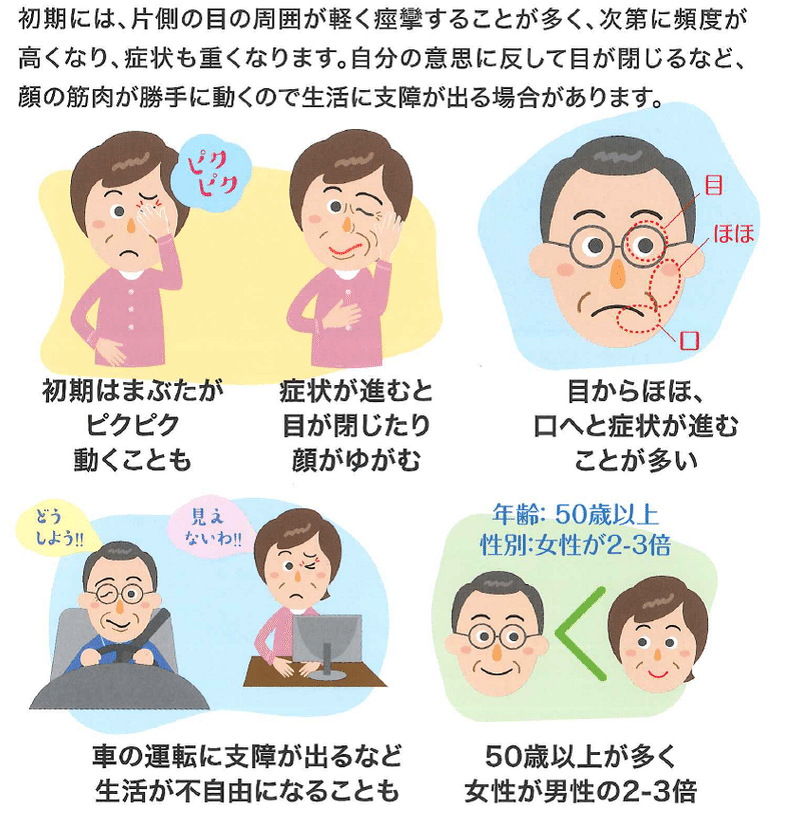 片側顔面痙攣 へんそくがんめんけいれん 金谷どうはん Note 片側顔面痙攣 へんそくがんめんけいれん 金谷どうはん Note