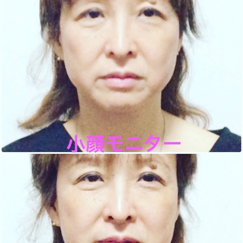 若返る小顔で人生が劇的に変わる 小顔ラボ Note