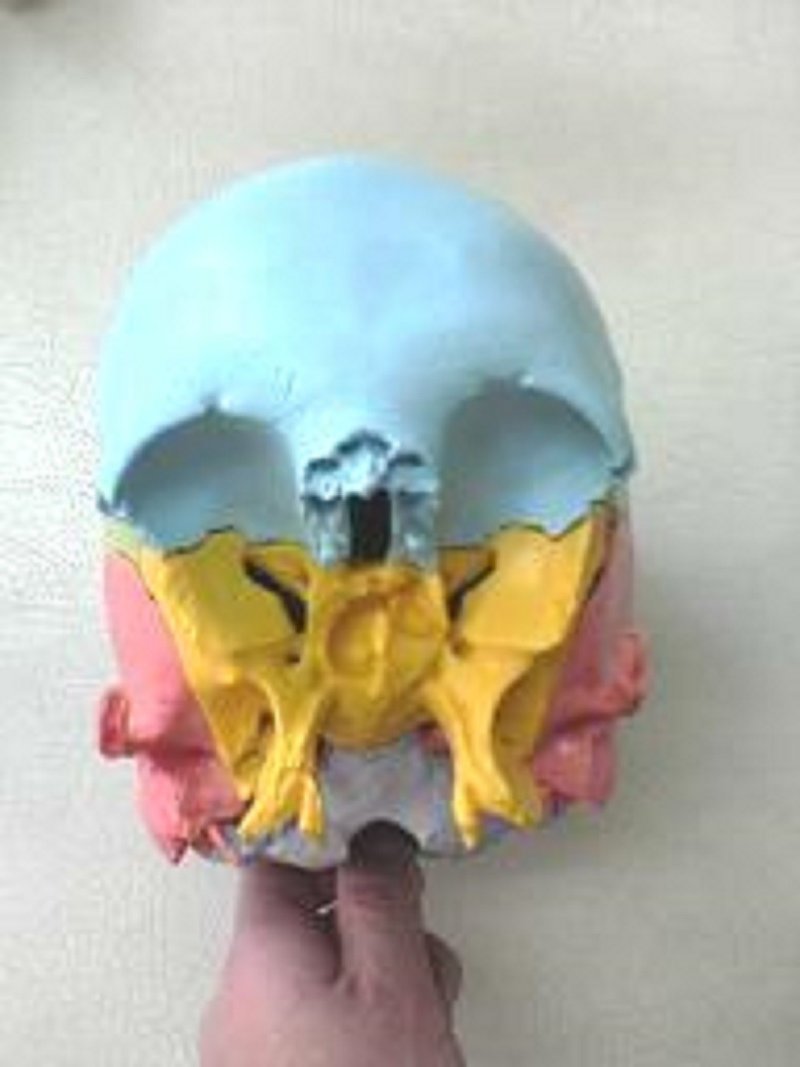蝶形骨　正面から　（黄）顔面と下顎骨はずし