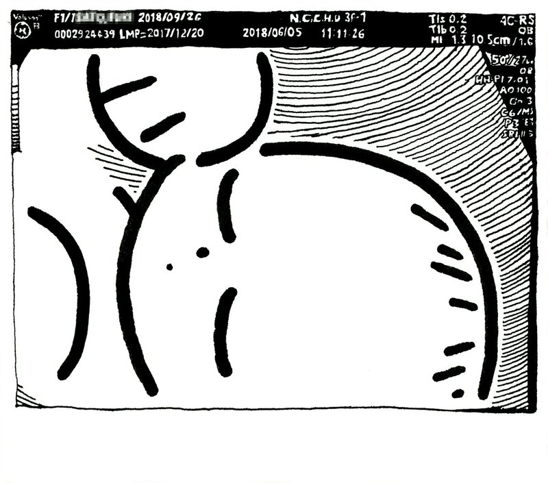 生まれる前の似顔絵 エコー画 佐藤ねじ ブルーパドル Note 生まれる前の似顔絵 エコー画 佐藤ねじ ブルーパドル Note
