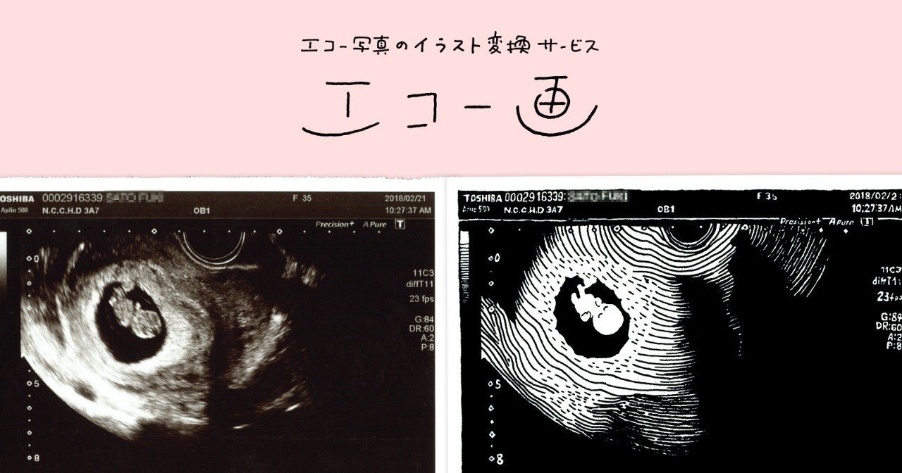 生まれる前の似顔絵 エコー画 佐藤ねじ ブルーパドル Note