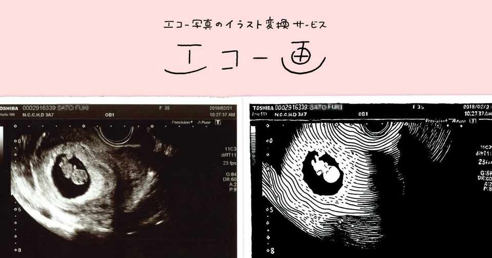 生まれる前の似顔絵 エコー画 佐藤ねじ ブルーパドル Note