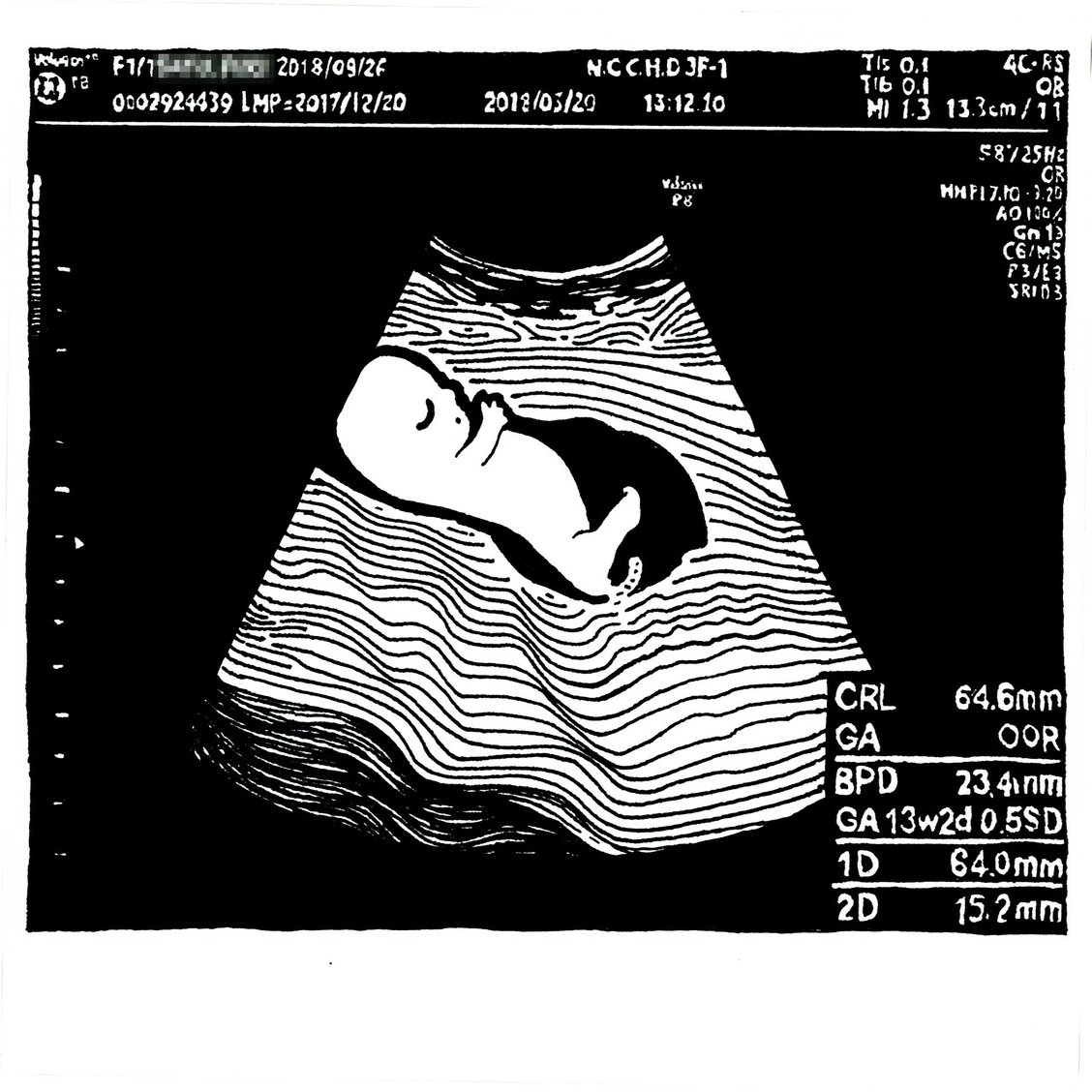 生まれる前の似顔絵 エコー画 佐藤ねじ ブルーパドル Note