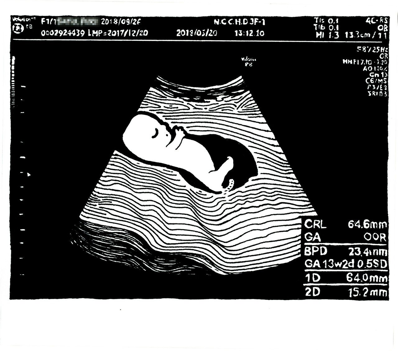 生まれる前の似顔絵 エコー画 佐藤ねじ ブルーパドル Note 生まれる前の似顔絵 エコー画 佐藤ねじ ブルーパドル Note