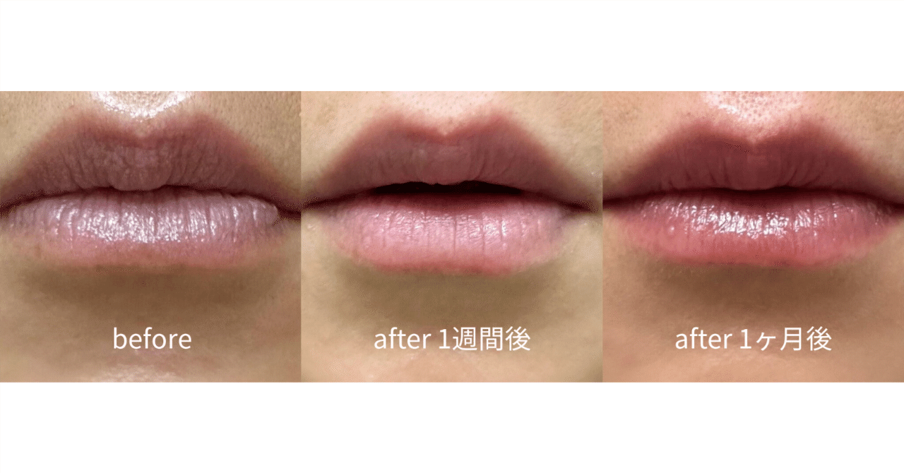 ローマピンク』 体験レポート｜アイリスト MARIKO MORITA (eyelash