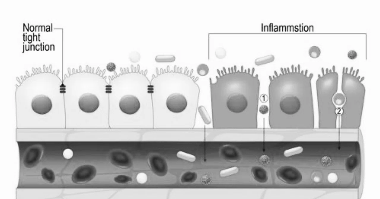 亜鉛補給はCACO-2ヒト腸管上皮層のタイトジャンクションを修飾し、バリア機能を変化させる