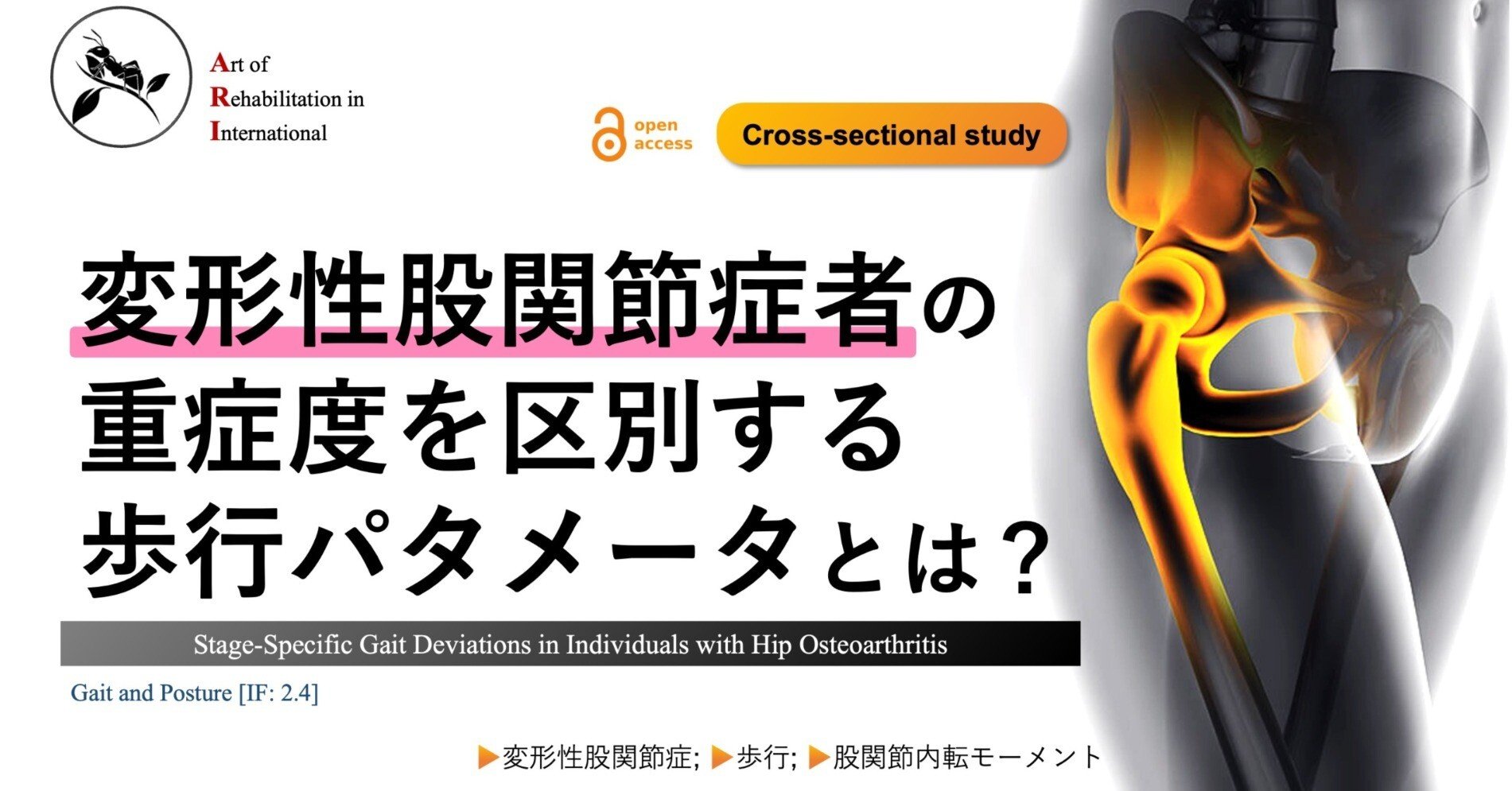 変形性股関節症者の重症度を区別する歩行パタメータとは