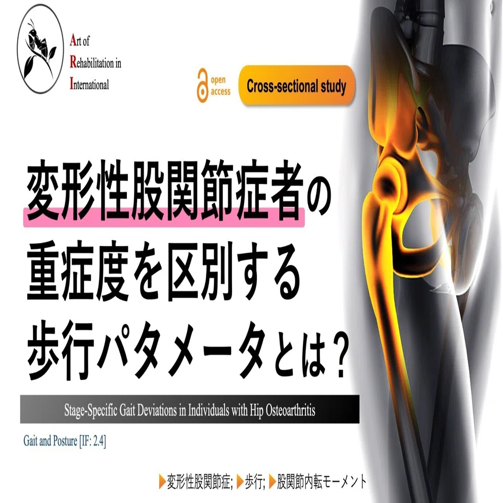 変形性股関節症者の重症度を区別する歩行パタメータとは？｜Super
