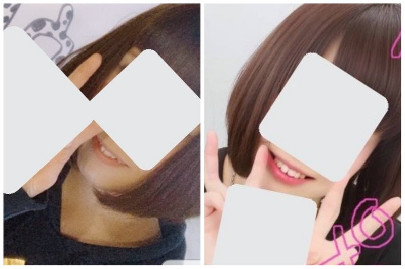 歯列矯正の経過 優 Note