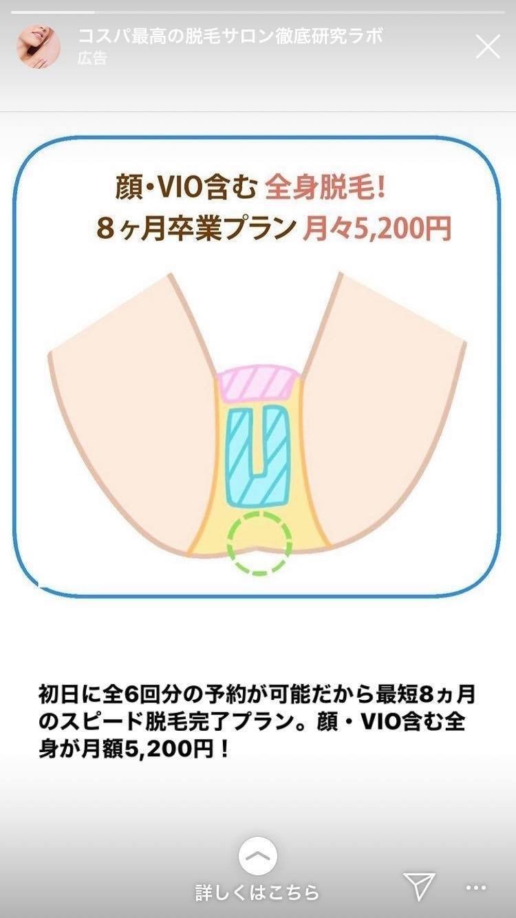 脱毛広告観察記4 尻の毛まで抜かれる世界 小林美香 Note 脱毛広告観察記4 尻の毛まで抜かれる世界 小林美香 Note