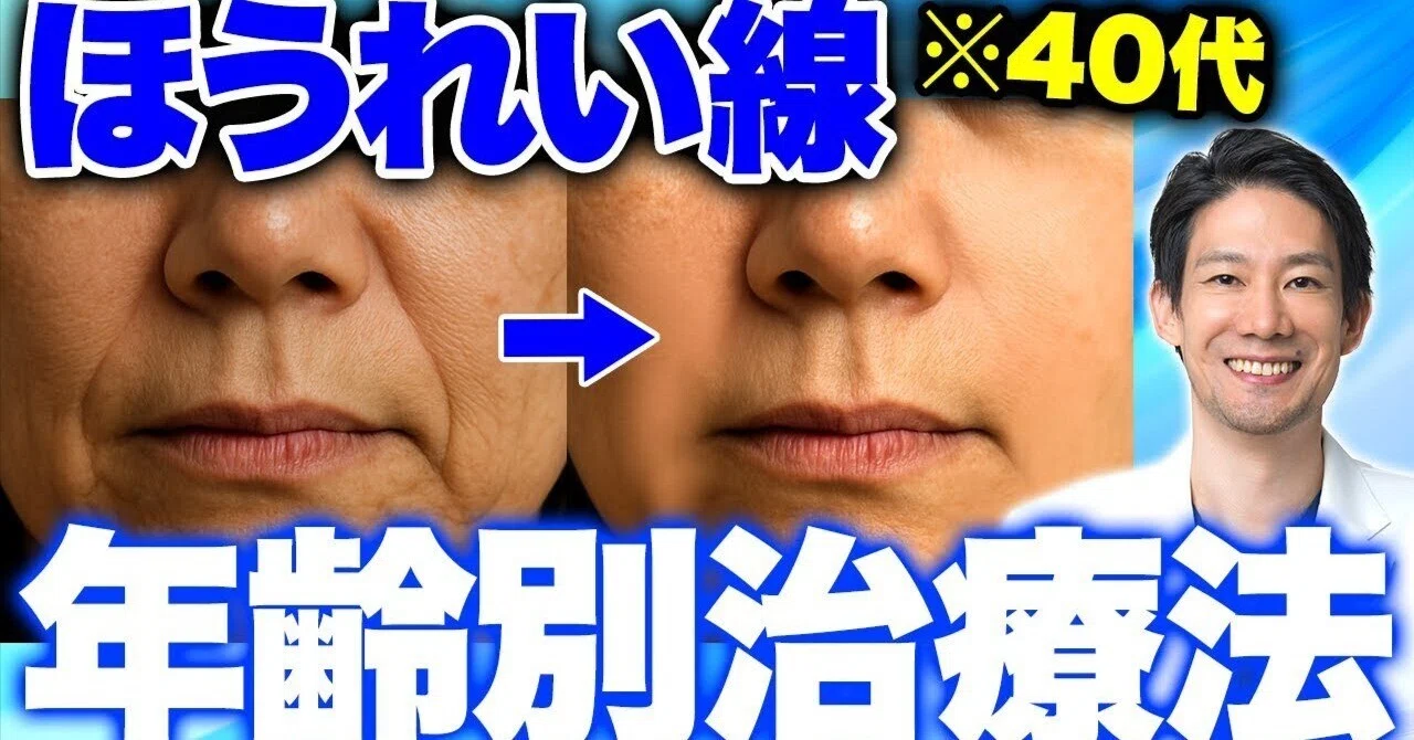 四つの機能 ほうれい線を作らない様に！ 医師が教える】ほうれい線は年齢で治療法が違います！年代別ベスト治療