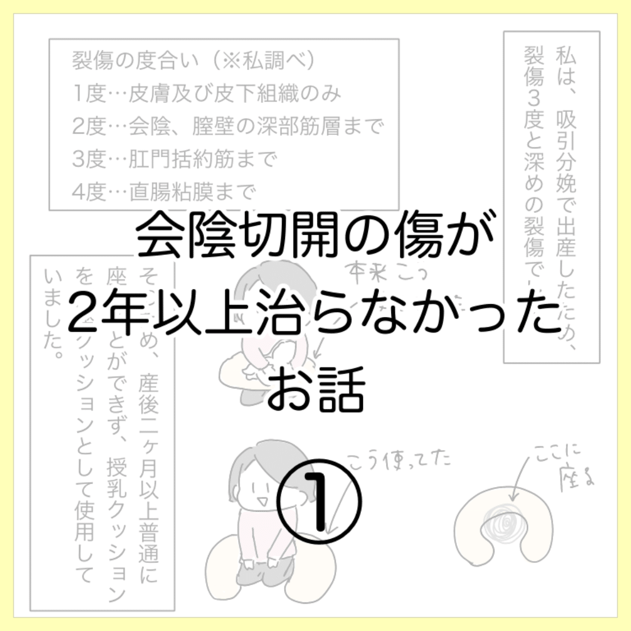 会陰切開の傷が2年以上治らなかったお話01 ひつじ Note 会陰切開の傷が2年以上治らなかったお話01 ひつじ Note