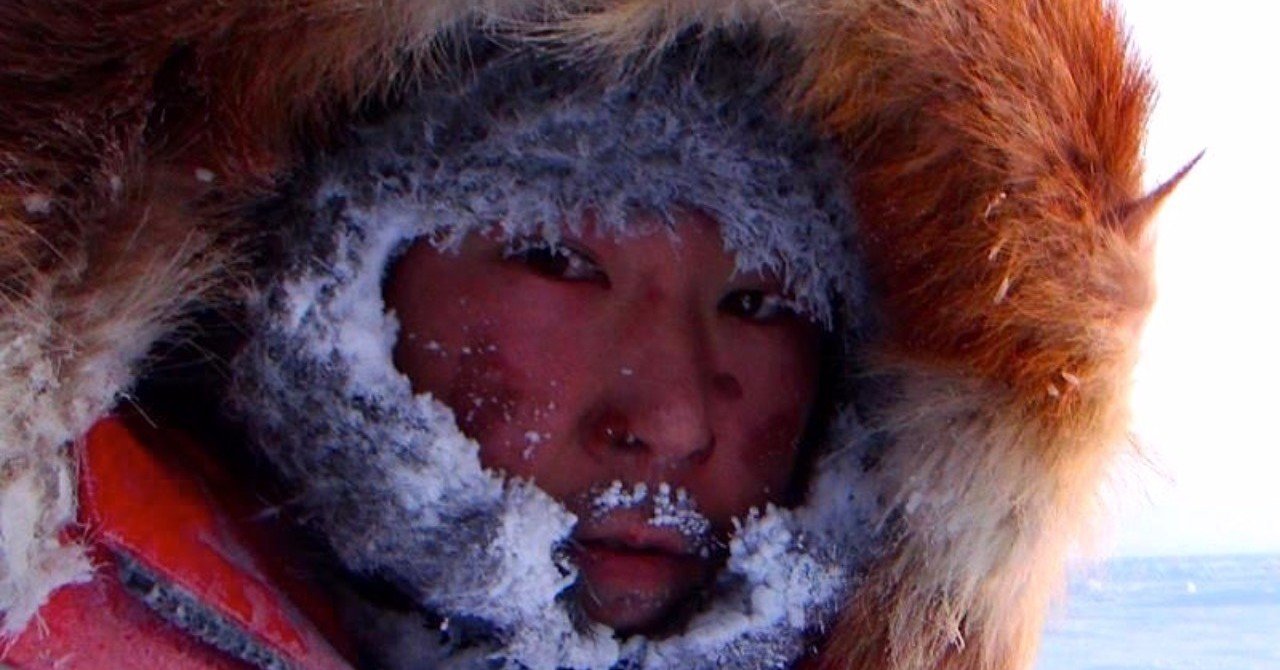 寒いから凍傷になる の間違い 北極冒険家 荻田泰永 Note 寒いから凍傷になる の間違い 北極冒険家 荻田泰永 Note
