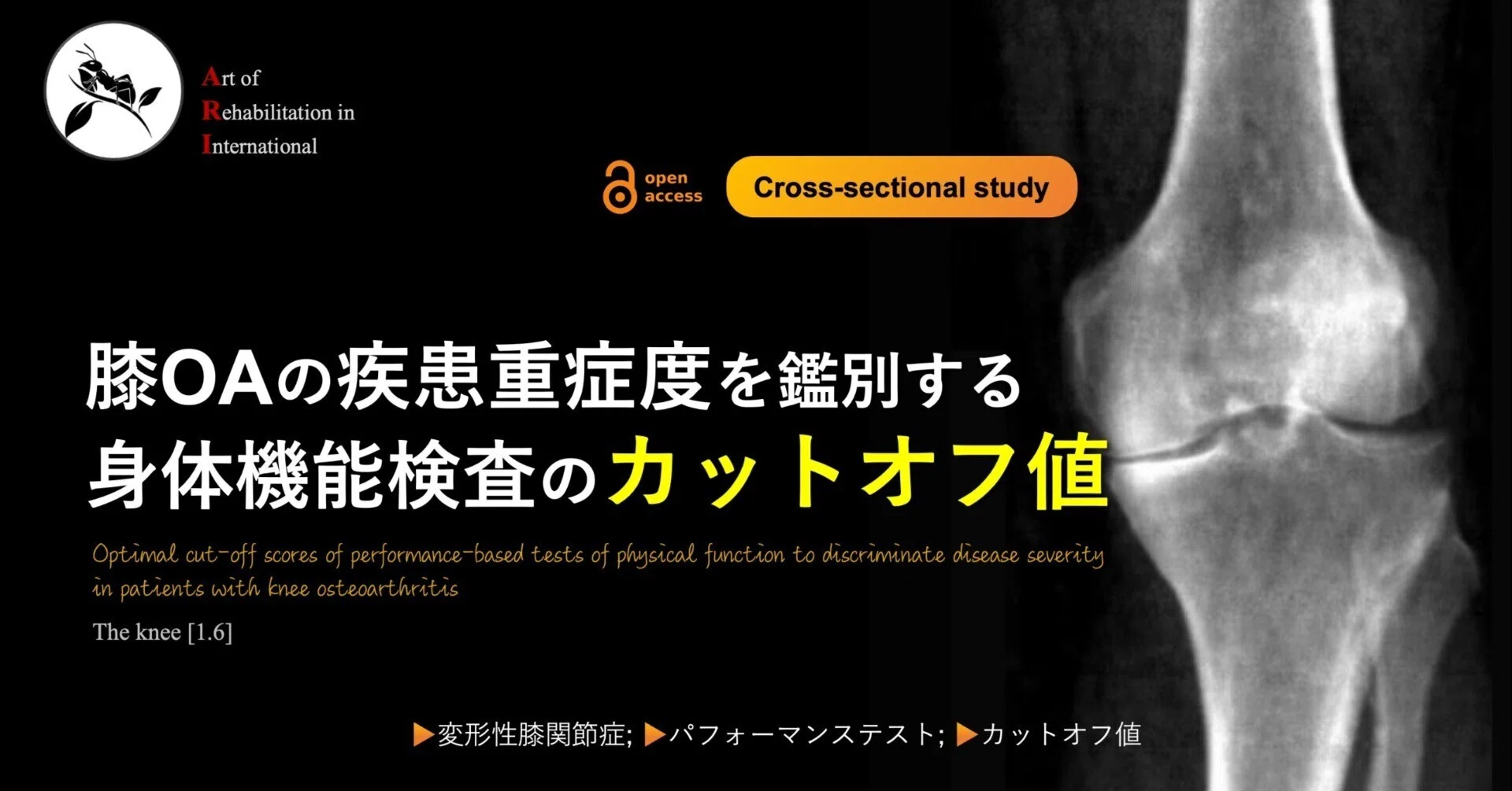 DVD 膝関節疾患に対する理学療法~変形性膝関節症を中心とした DVD 膝関節疾患に対する理学療法~変形性膝関節症を中心とした