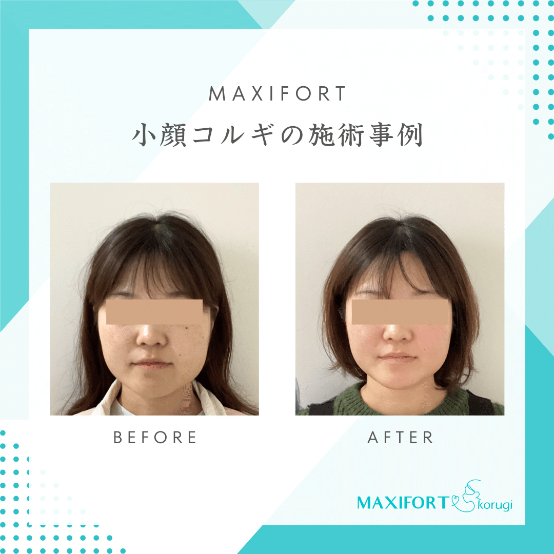 エグランス　ナイトクリーム2個　小顔むくみ解消 Egglance / エグランス ナイトブレンドの公式商品情報｜美容