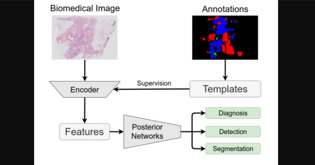 T-Net: A Magic Network for Aligning the 'Orientation and Scale' of ...