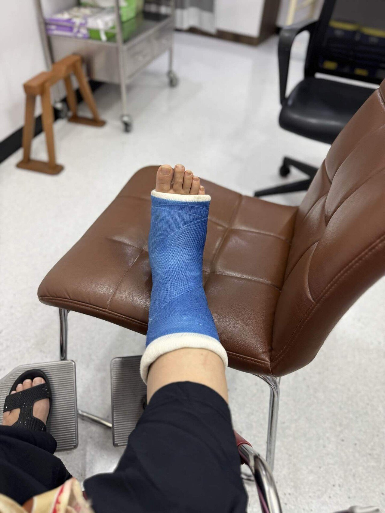 AIRCAST AIRSELECT エリート 骨折後のギプス