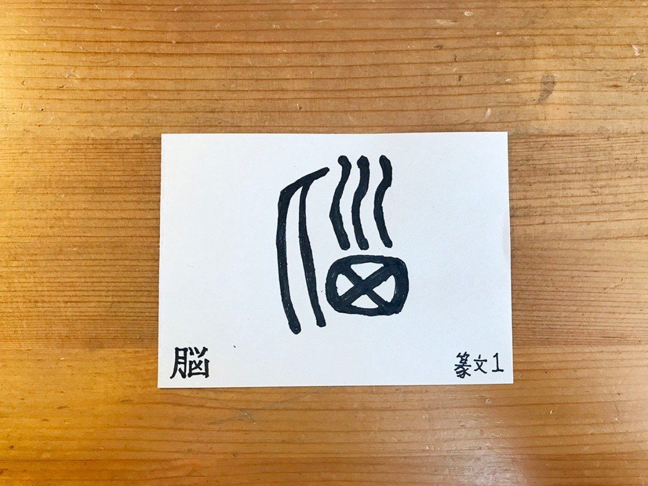 悩 と 脳 と ひよめき と 鈴木秀之 Note 悩 と 脳 と ひよめき と 鈴木秀之 Note