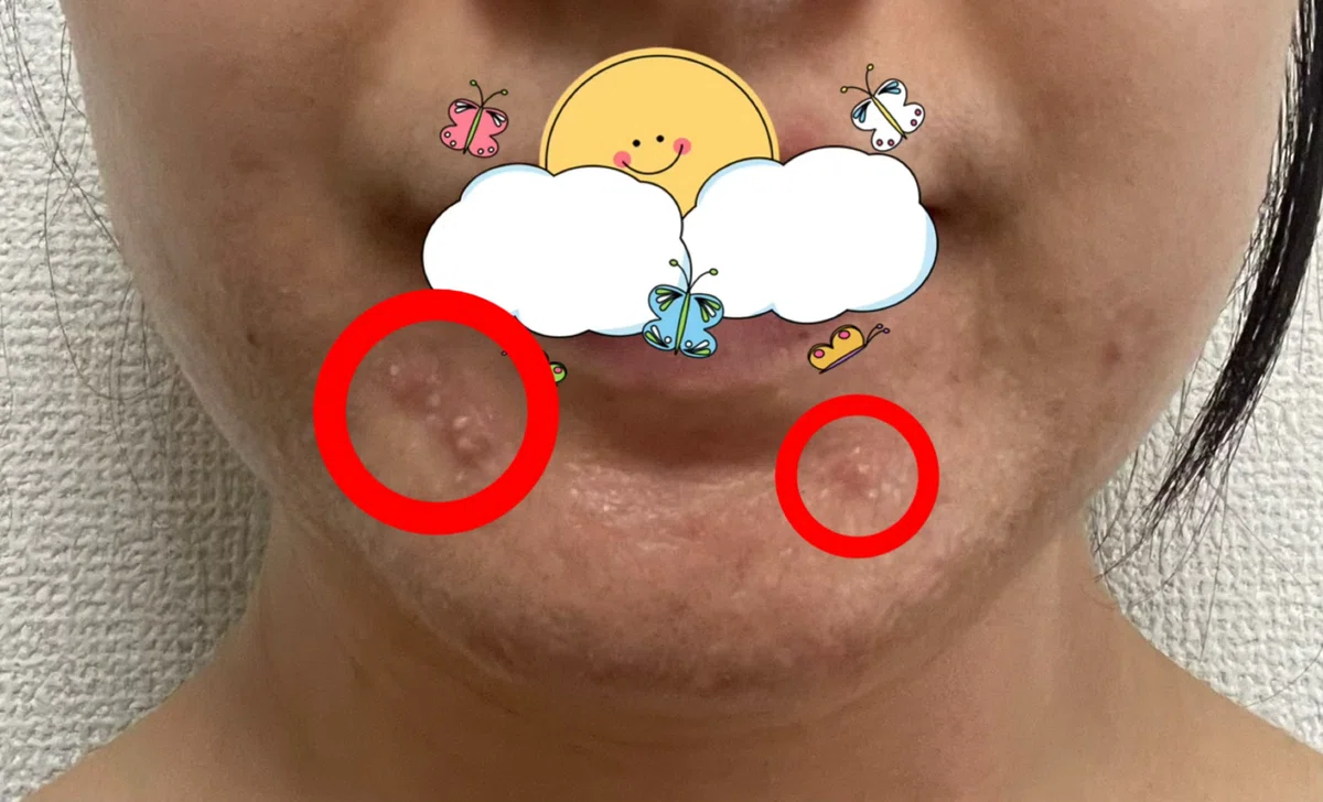 画像