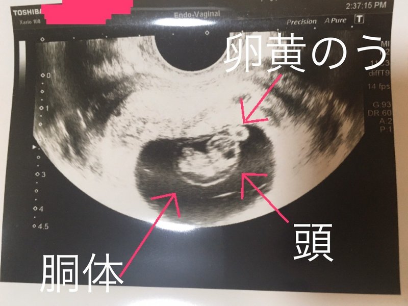 実録 母子手帳交付 つわりを乗り越え安定期胎動開始 妊婦体験ブログ 4 第6週 2ヶ月 第28週 7ヶ月 までの超ダイジェスト 激励マダム まお Private Memo Note 実録 母子手帳交付 つわりを乗り越え安定期胎動開始 妊婦体験ブログ 4 第6週 2ヶ月 第28週 7ヶ月 までの超ダイジェスト 激励マダム まお Private Memo Note