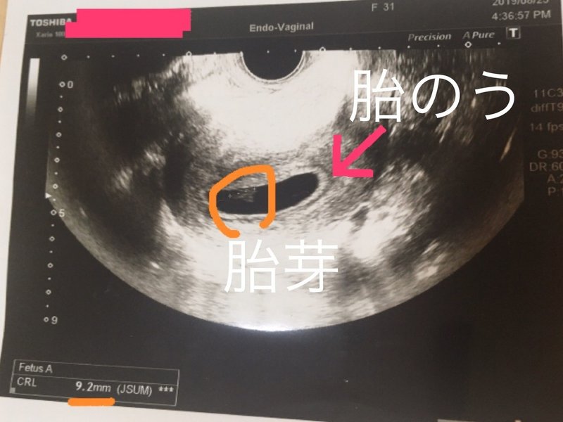 実録 母子手帳交付 つわりを乗り越え安定期胎動開始 妊婦体験ブログ 4 第6週 2ヶ月 第28週 7ヶ月 までの超ダイジェスト 激励マダム まお Private Memo Note