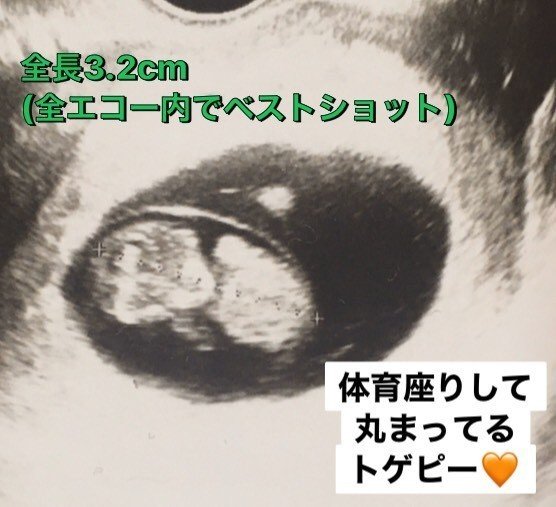 実録 母子手帳交付 つわりを乗り越え安定期胎動開始 妊婦体験ブログ 4 第6週 2ヶ月 第28週 7ヶ月 までの超ダイジェスト 激励マダム まお Private Memo Note 実録 母子手帳交付 つわりを乗り越え安定期胎動開始 妊婦体験ブログ 4 第6週 2ヶ月 第28週 7ヶ月 までの超ダイジェスト 激励マダム まお Private Memo Note