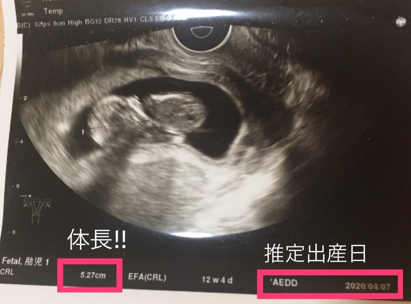 実録 母子手帳交付 つわりを乗り越え安定期胎動開始 妊婦体験ブログ 4 第6週 2ヶ月 第28週 7ヶ月 までの超ダイジェスト 激励マダム まお Private Memo Note 実録 母子手帳交付 つわりを乗り越え安定期胎動開始 妊婦体験ブログ 4 第6週 2ヶ月 第28週 7ヶ月 までの超ダイジェスト 激励マダム まお Private Memo Note
