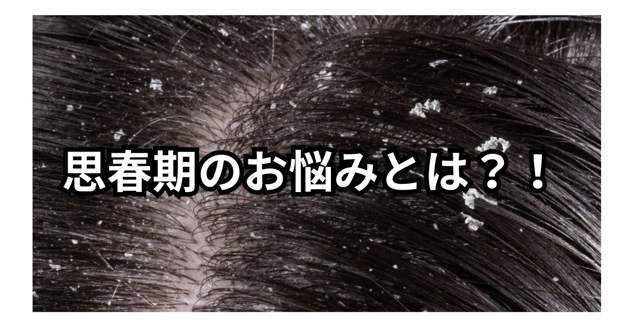 中学生 フケ