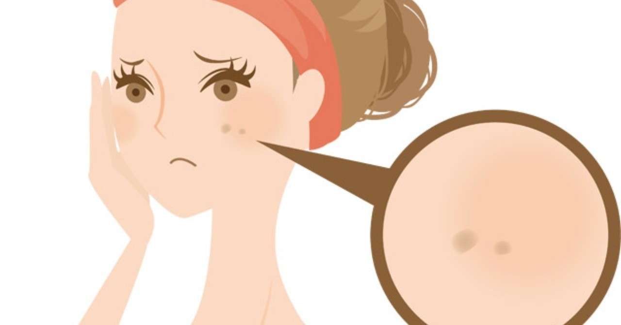 美白 シミを消す化粧品の選び方 うさぎ猫 Note