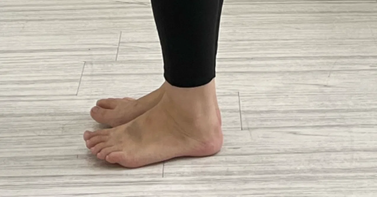 Hey there, lower back pain sufferer, are your toes lifting off the ...