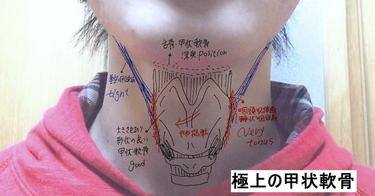 (エッセイ)不本意な、喉仏の切除手術体験(備忘録)|YUKI