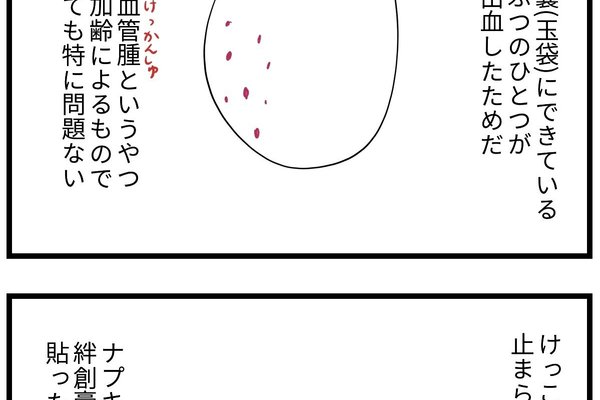 陰嚢被角血管腫 の新着タグ記事一覧 Note つくる つながる とどける 陰嚢被角血管腫 の新着タグ記事一覧 Note つくる つながる とどける