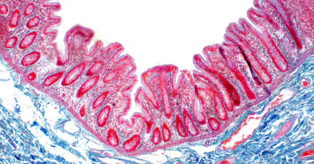 最新｜「腸内細菌叢は健康の鍵ではなく、腸のバリアなのです」と微生物学者は言う