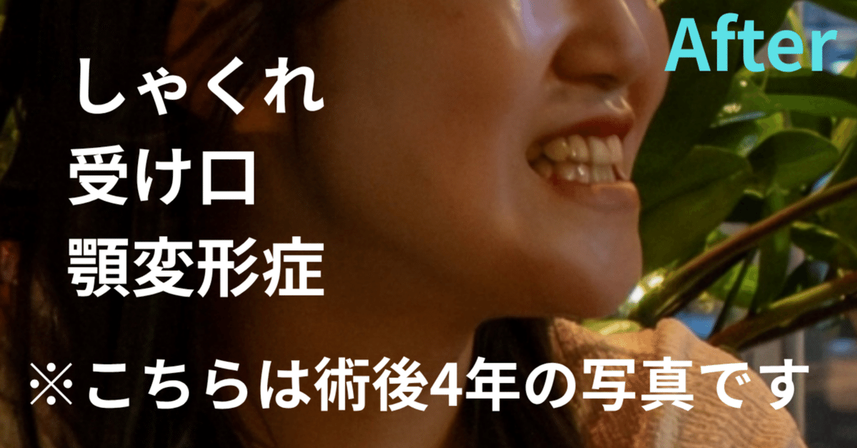 顎変形症の手術をしたけど、美容で再手術になった話💭｜シンドミ