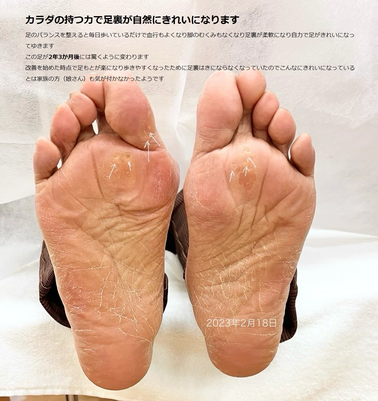 足裏が見違えるように綺麗になる｜ask_me